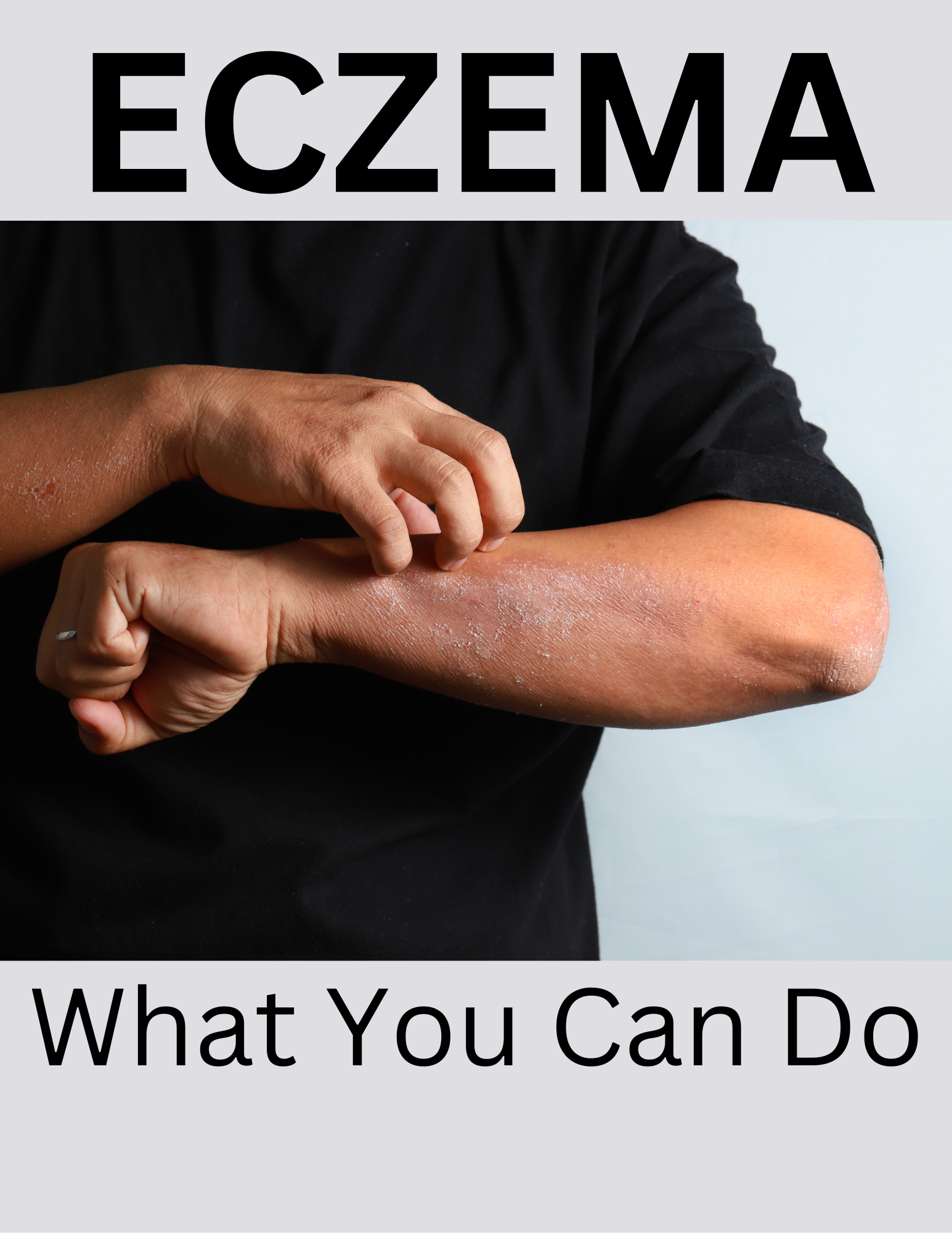 Eczema: What You Can Do